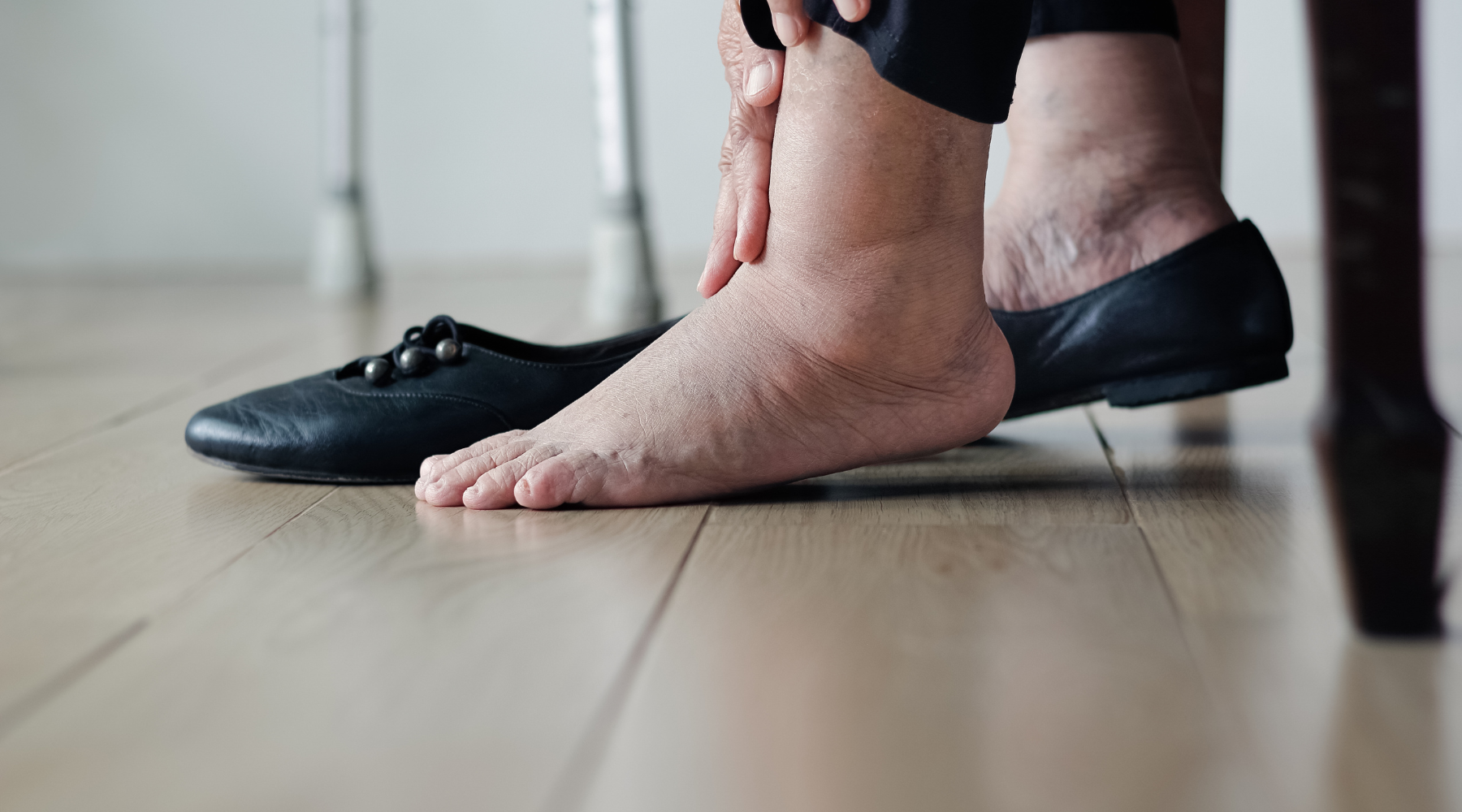 Sweaty Feet Diabetes: The Surprising Connection Explained