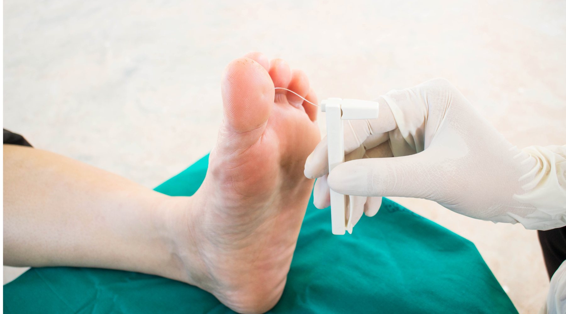 A Diabetic Neuropathy Picture: Understanding Symptoms and Treatment